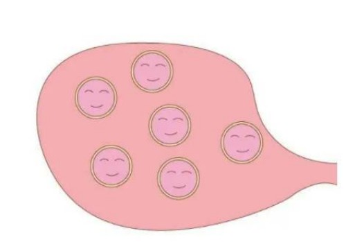 天津代生代怀公司：试管婴儿绝育，把生育控制权留在自己手里