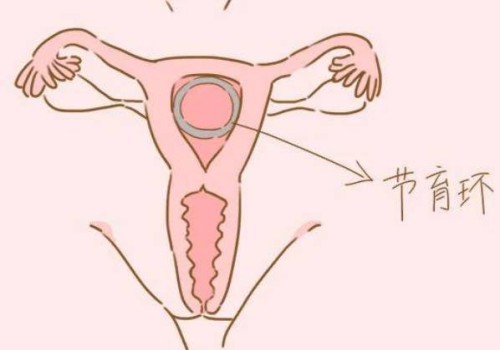 2022年天津试管婴儿政策最新解读：医保报销也有条件